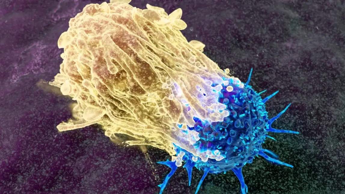 CAR-T Cell Therapy
